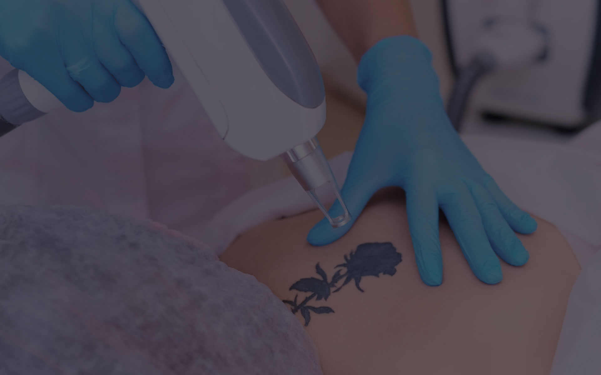 Eliminación de tatuajes