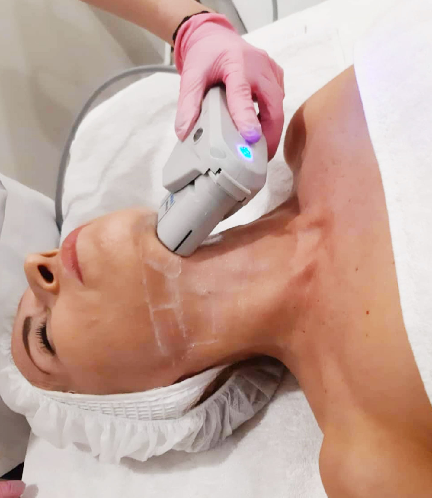 Remodelación facial